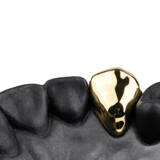 Single Cap Grillz - Custom Fit