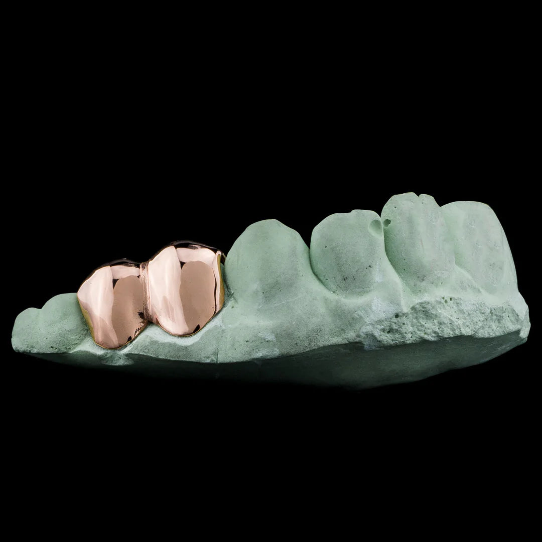 Double Cap Grillz - Custom Fit - Bor & co.