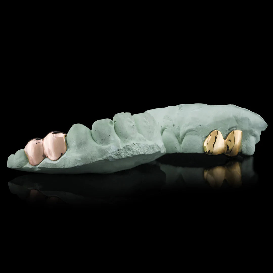 Double Cap Grillz - Custom Fit - Bor & co.