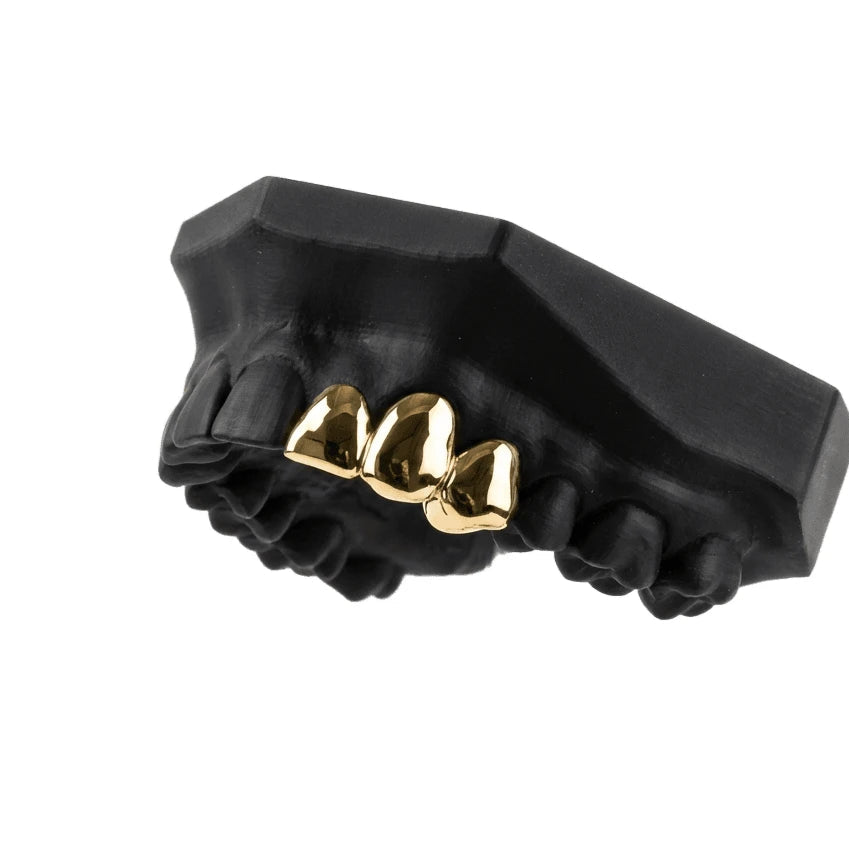 3 Cap Custom Grillz – Solid, 2+1, or Separated – Silver & Gold