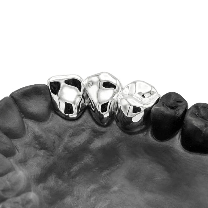 3 Cap Custom Grillz – Solid, 2+1, or Separated – Silver & Gold