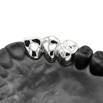 3 Cap Custom Grillz – Solid, 2+1, or Separated – Silver & Gold