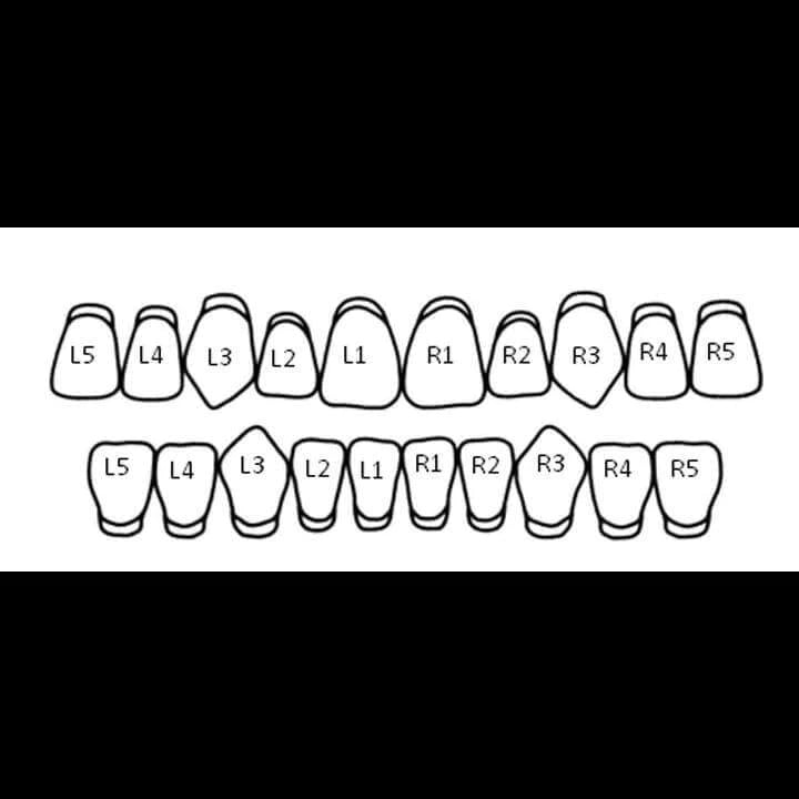 Double Cap Grillz - Custom Fit - Bor & co.